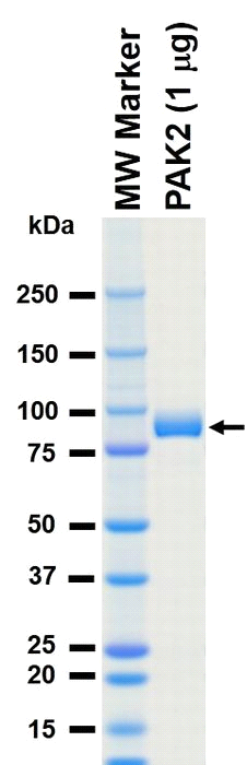 The purity was assessed by SDS-PAGE/CBB staining.
